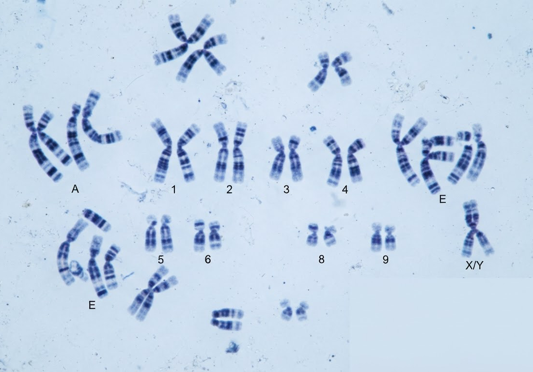 Cromossomos humanos corados por bandeamento G em lâmina de microscópio, com faixas claras alternadas com longas faixas escuras sob luz de laboratório